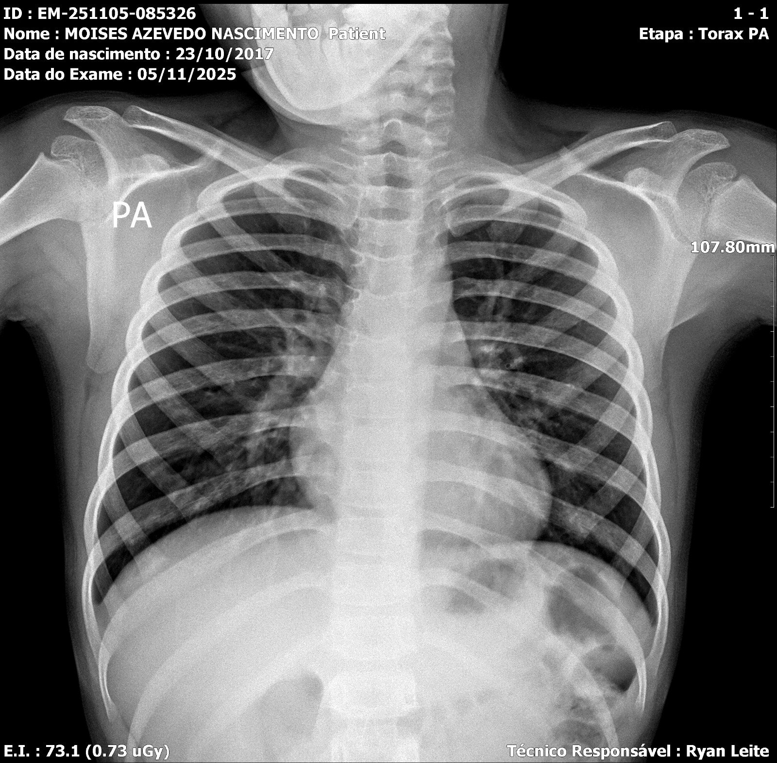 Demonstração - Imagem Médica Original